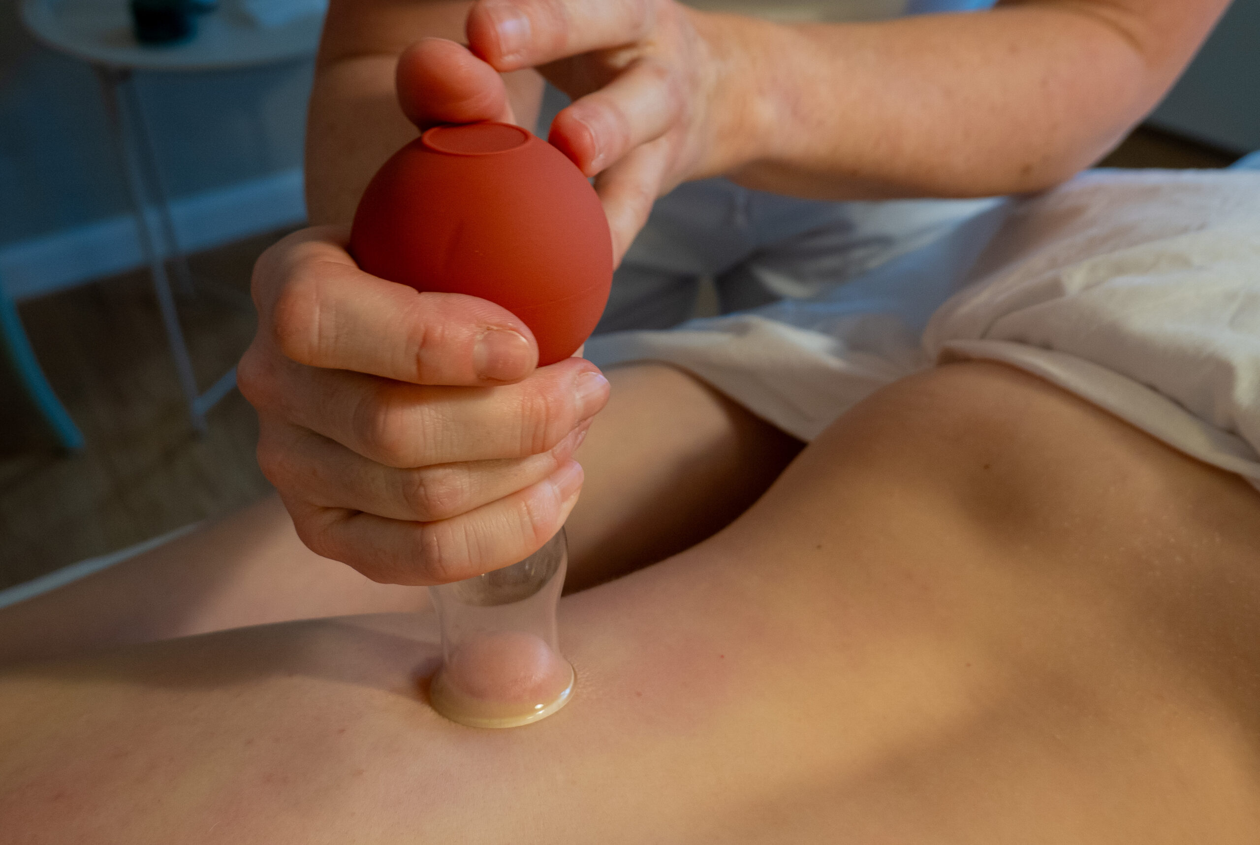 Bindevævsmassage – cupping-teknik